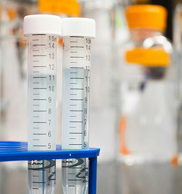 Reagenzgläser in Halterung